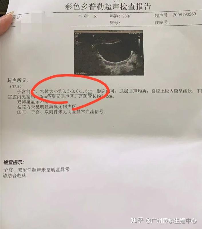 河南郑州博爱试管助孕咨询婴儿多少钱（附试管做男孩价格收费详细表!）
